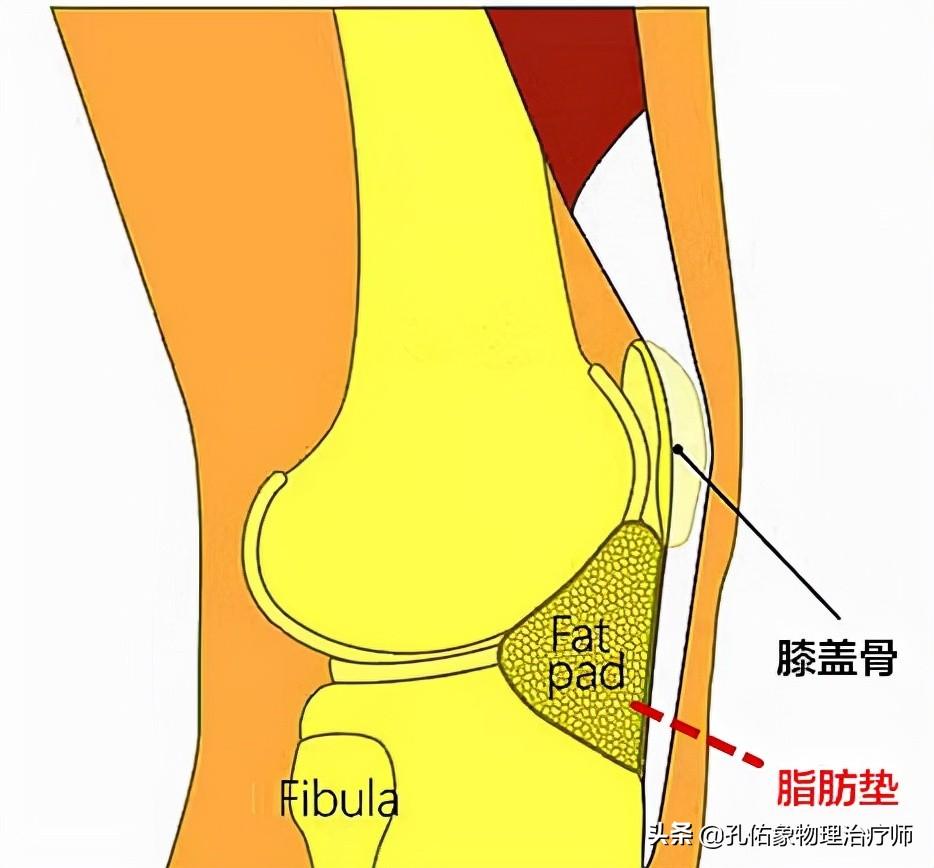 膝关节疼痛什么原因？膝前疼痛是怎么回事？