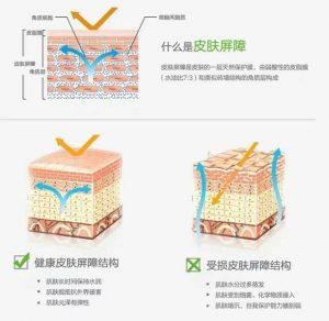 春天脸上过敏怎么办？春季脸部皮肤过敏症状是怎样的？