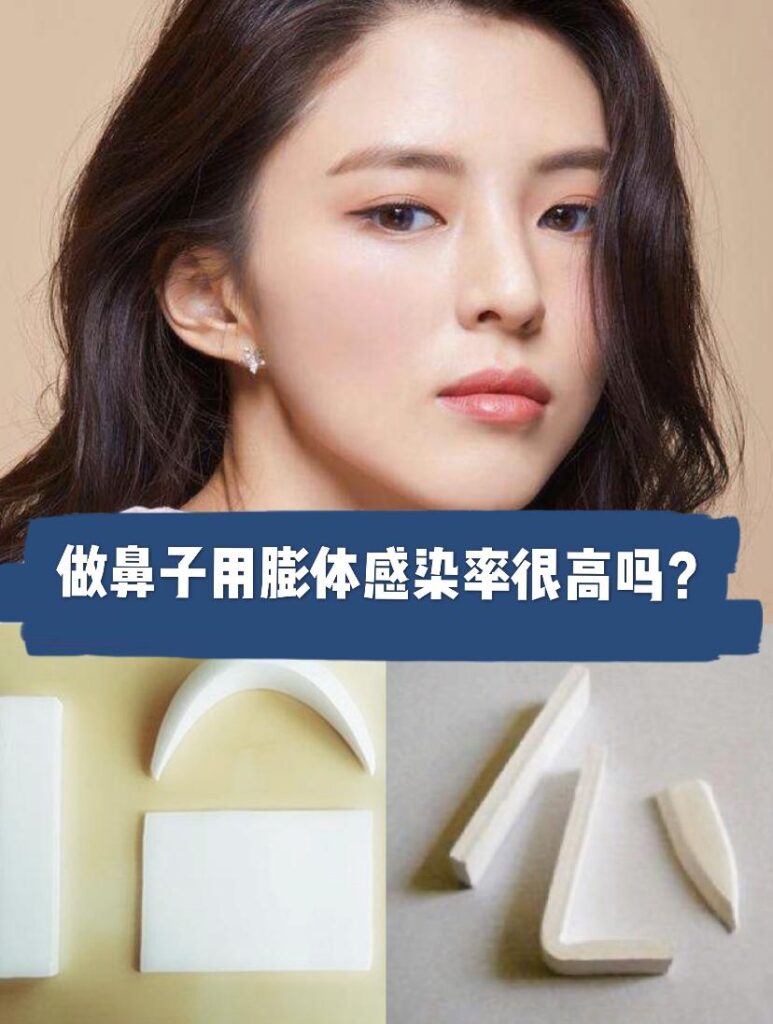 做膨体隆鼻有风险吗?用膨体容易感染吗？